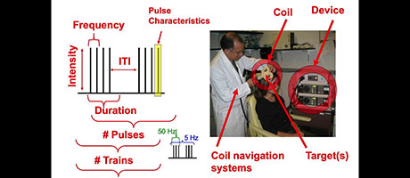 screenshot from NIMH video: Dr. Bruce Luber – TMS Parameters and Protocols